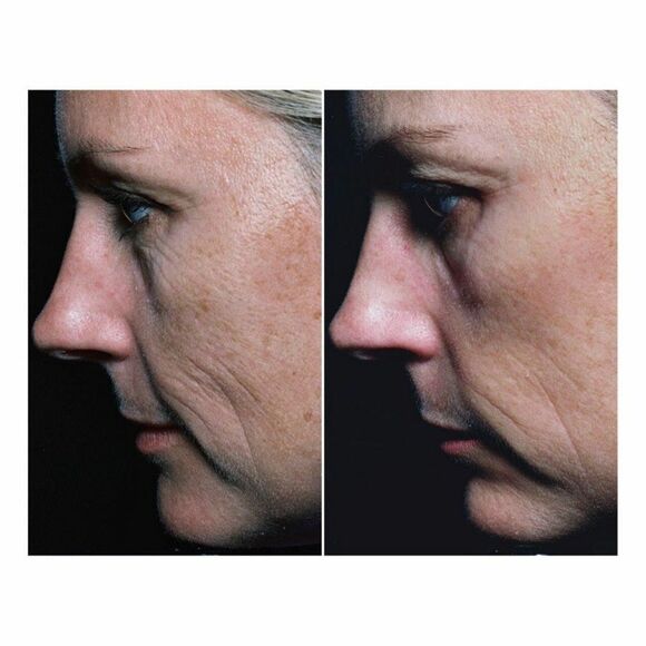 Somme Institute Exfoliating Transport Pads - Picture 7 of 13